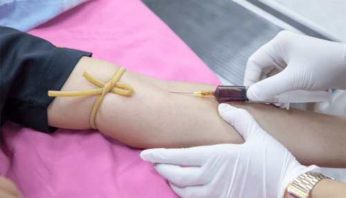Fear Of Needles